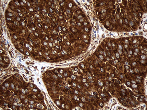 m09736 anti rpl27 mouse monoclonal antibody clone id oti6d3 ihc testing 3