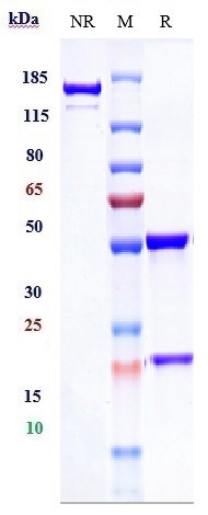 Anti-DCBLD2/ESDN Reference Antibody (FA19-1) on SDS-PAGE under reducing (R) condition