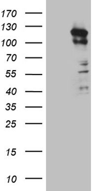 HEK293T cells were transfected with the pCMV6-ENTRY control (Left lane) or pCMV6-ENTRY PKN3 (Right lane) cDNA for 48 hrs and lysed