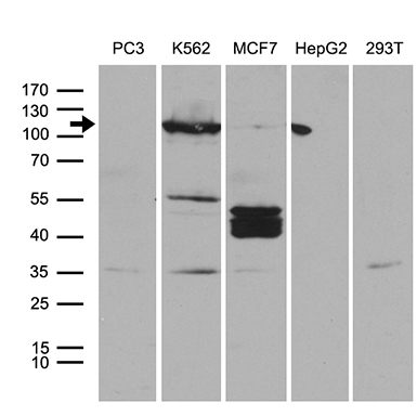 Western blot analysis of extracts (35ug) from 5 different cell lines by using anti-PKN3 monoclonal antibody (1:500)