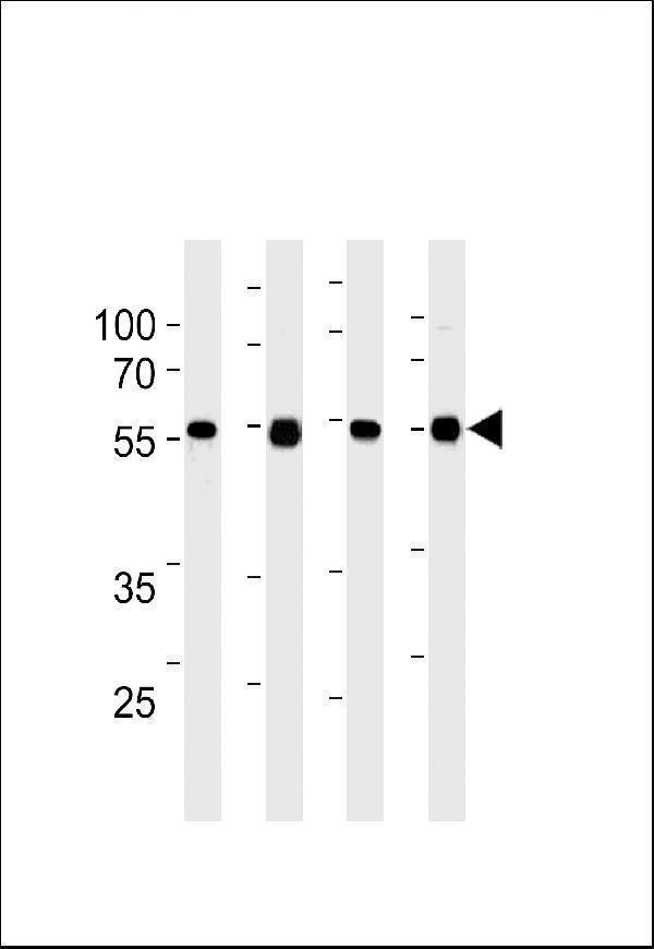 TPIPb Antibody (C-term) western blot analysis in 293,A431,A2058,mouse NIH/3T3 cell line lysates (35μg/lane)