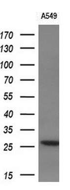 Western blot analysis of extracts (10ug) from 1 cell line by using anti-IL1F6 monoclonal antibody (1:200)