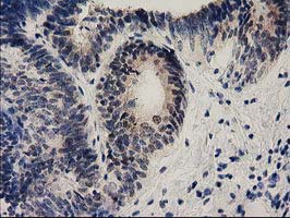 m09844 anti ephrin a2 efna2 mouse monoclonal antibody clone id oti3e3 ihc testing 2