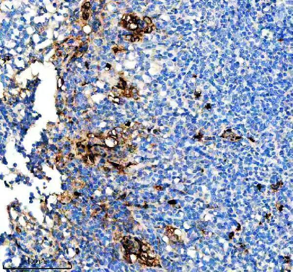 m09845 cd163l1 primary antibodies ihc testing 1