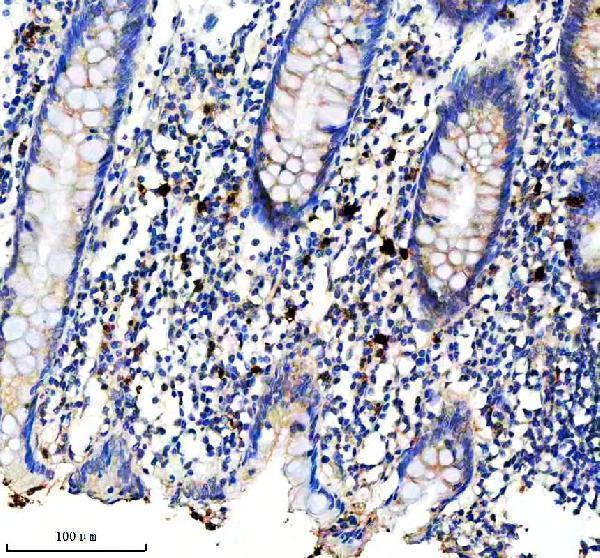 m09845 cd163l1 primary antibodies ihc testing 2