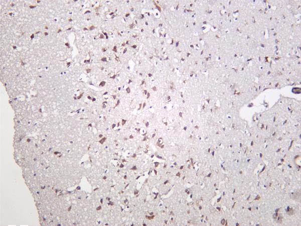 Rat brain was stained with anti-YTHDF1 rabbit antibody