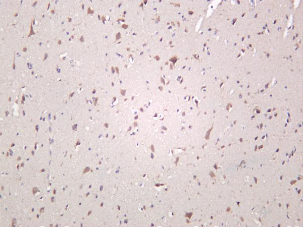 Human brain was stained with anti-YTHDF1 rabbit antibody