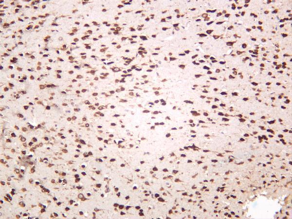 Mouse brain was stained with anti-YTHDF1 rabbit antibody