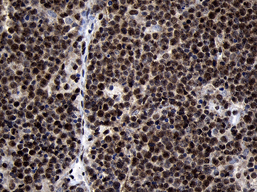 m09869 anti hoxc4 mouse monoclonal antibody clone id oti2d5 ihc testing 14