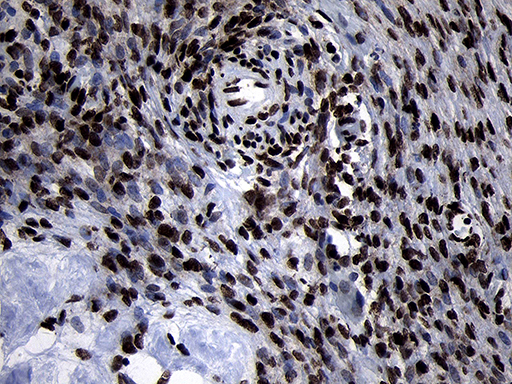 m09869 anti hoxc4 mouse monoclonal antibody clone id oti2d5 ihc testing 4