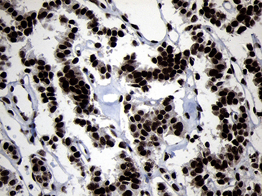 m09869 anti hoxc4 mouse monoclonal antibody clone id oti2d5 ihc testing 7