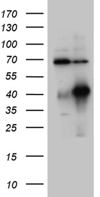 HEK293T cells were transfected with the pCMV6-ENTRY control (Left lane) or pCMV6-ENTRY HOXC4 (Right lane) cDNA for 48 hrs and lysed