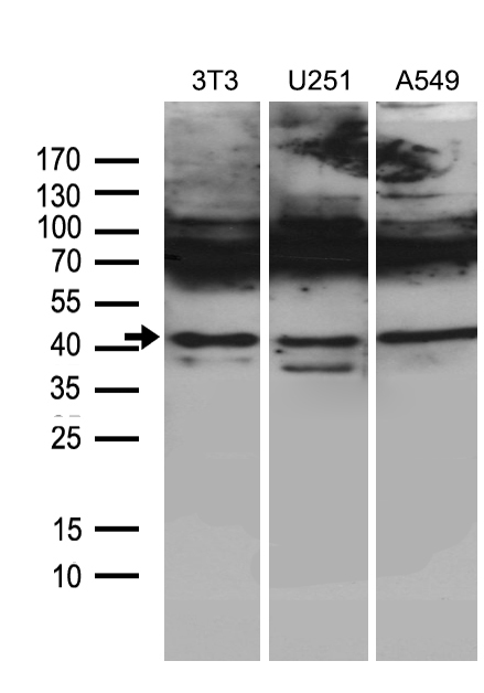 Western blot analysis of extracts (35ug) from 3 different cell lines by using anti-HOXC4 monoclonal antibody (1:500)
