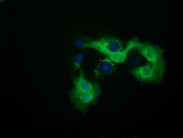 m09896 anti qprt mouse monoclonal antibody clone id oti1c10 if testing 13