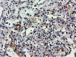 m09896 anti qprt mouse monoclonal antibody clone id oti1c10 ihc testing 10
