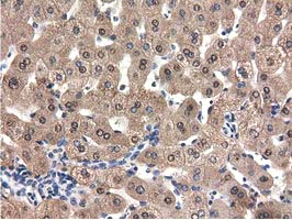 m09896 anti qprt mouse monoclonal antibody clone id oti1c10 ihc testing 11
