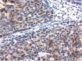 m09896 anti qprt mouse monoclonal antibody clone id oti1c10 ihc testing 3