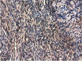 m09896 anti qprt mouse monoclonal antibody clone id oti1c10 ihc testing 4