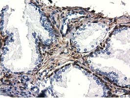 m09896 anti qprt mouse monoclonal antibody clone id oti1c10 ihc testing 5