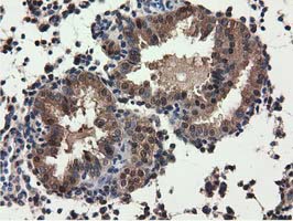 m09896 anti qprt mouse monoclonal antibody clone id oti1c10 ihc testing 6