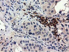 m09896 anti qprt mouse monoclonal antibody clone id oti1c10 ihc testing 7