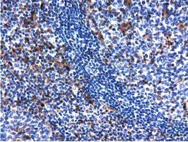 m09896 anti qprt mouse monoclonal antibody clone id oti1c10 ihc testing 8