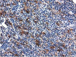 m09896 anti qprt mouse monoclonal antibody clone id oti1c10 ihc testing 9
