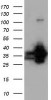 m09896 anti qprt mouse monoclonal antibody clone id oti1c10 wb testing 1