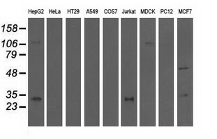 m09896 anti qprt mouse monoclonal antibody clone id oti1c10 wb testing 2