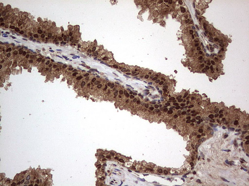 m09931 anti macro h2a
