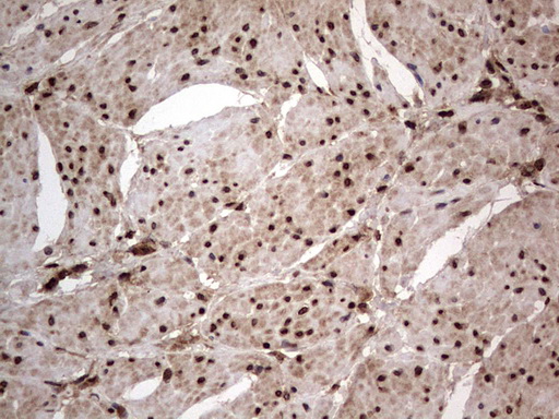 m09931 anti macro h2a