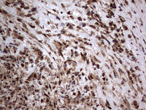 m09931 anti macro h2a