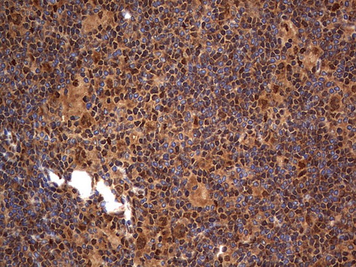 m09931 anti macro h2a