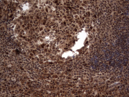 m09931 anti macro h2a