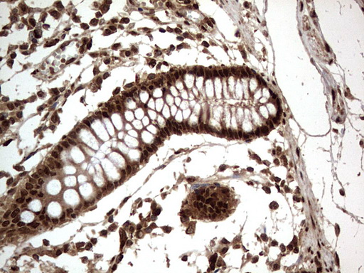 m09931 anti macro h2a