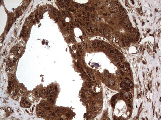 m09931 anti macro h2a