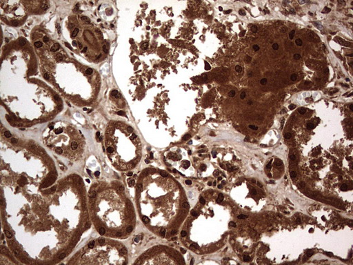 m09931 anti macro h2a
