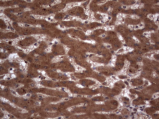 m09931 anti macro h2a