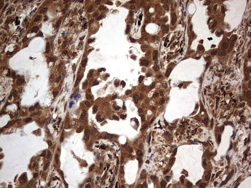 m09931 anti macro h2a