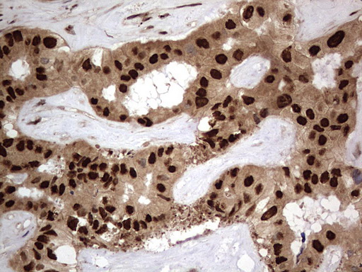 m09931 anti macro h2a
