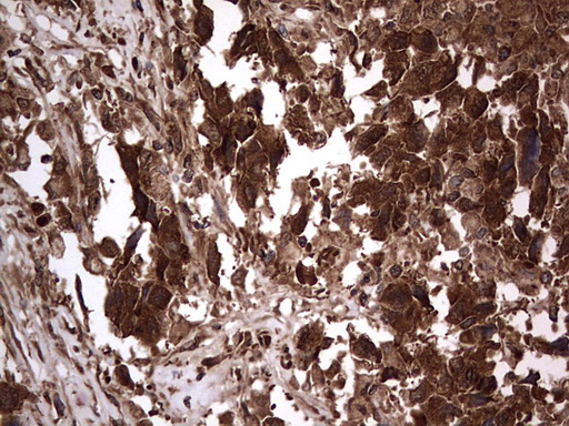 m09931 anti macro h2a