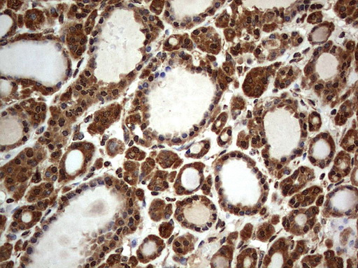m09931 anti macro h2a