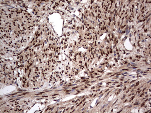 m09931 anti macro h2a