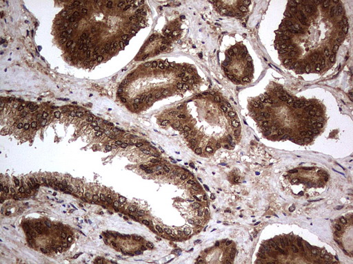 m09931 anti macro h2a