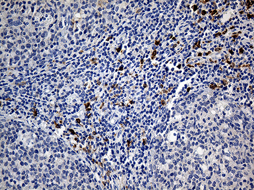 Immunohistochemical staining of paraffin-embedded Human tonsil within the normal limits using anti-CLEC10A mouse monoclonal antibody