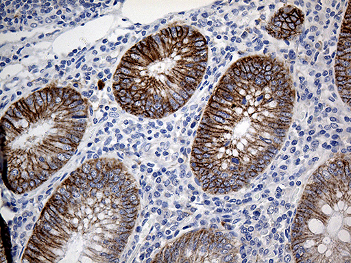m09933 anti clec10a mouse monoclonal antibody clone id oti2b10 ihc testing 4