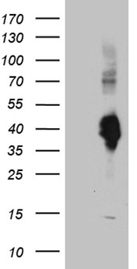 HEK293T cells were transfected with the pCMV6-ENTRY control (Left lane) or pCMV6-ENTRY CLEC10A (Right lane) cDNA for 48 hrs and lysed