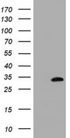 HEK293T cells were transfected with the pCMV6-ENTRY control (Left lane) or pCMV6-ENTRY MMADHC (Right lane) cDNA for 48 hrs and lysed. Equivalent amounts of cell lysates (5 ug per lane) were separated by SDS-PAGE and immunoblotted with anti-MMADHC.