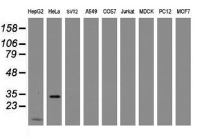 Western blot analysis of extracts (35ug) from 9 different cell lines by using anti-MMADHC monoclonal antibody (HepG2: human; HeLa: human; SVT2: mouse; A549: human; COS7: monkey; Jurkat: human; MDCK: canine; PC12: rat; MCF7: human). Western blot analysis of extracts (35ug) from 9 different cell lines by using anti-MMADHC monoclonal antibody (HepG2: human; HeLa: human; SVT2: mouse; A549: human; COS7: monkey; Jurkat: human; MDCK: canine; PC12: rat; MCF7: human).
