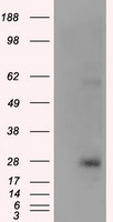 HEK293T cells were transfected with the pCMV6-ENTRY control (Left lane) or pCMV6-ENTRY KCTD5 (Right lane) cDNA for 48 hrs and lysed. Equivalent amounts of cell lysates (5 ug per lane) were separated by SDS-PAGE and immunoblotted with anti-KCTD5.